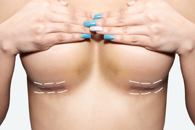 Scar,After,Breast,Surgery,On,White,Background