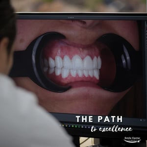 Close-up of dental mouth opener used during cosmetic consultation.